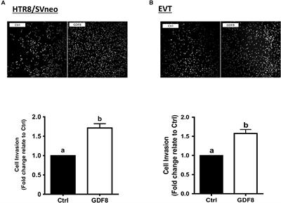 GDF8 Promotes the Cell Invasiveness in Human Trophoblasts by Upregulating the Expression of Follistatin-Like 3 Through the ALK5-SMAD2/3 Signaling Pathway